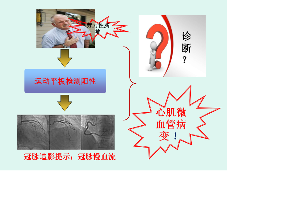 心肌微血管病变(正稿).ppt_第2页