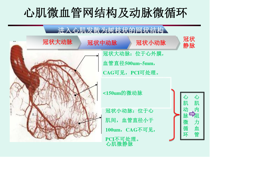 心肌微血管病变(正稿).ppt_第3页