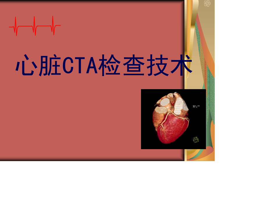 心脏CTA检查.ppt_第1页