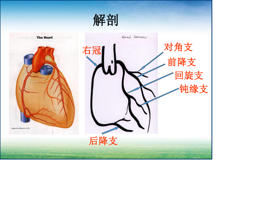 体外循环下冠脉搭桥术.ppt_第3页