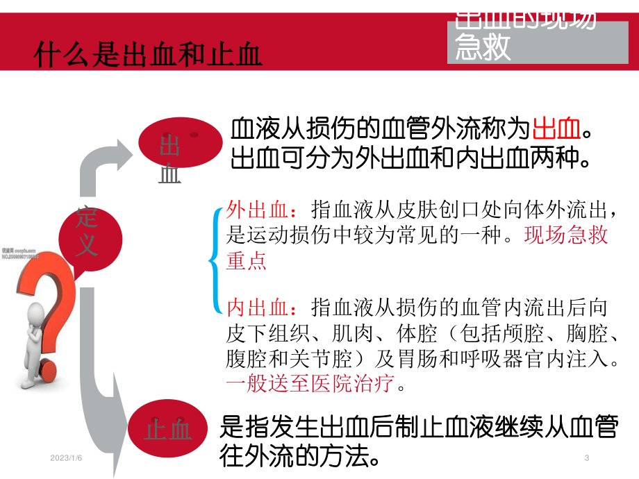 现场急救之出血.ppt_第3页