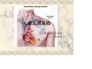 心脏起搏基础.ppt