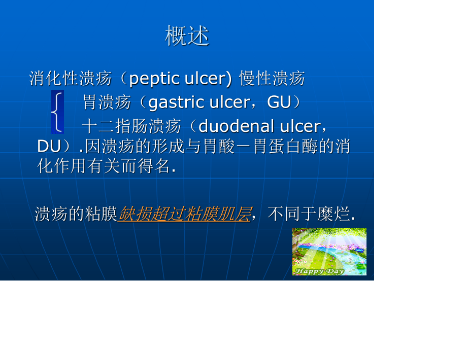 消化性溃疡2.ppt_第2页