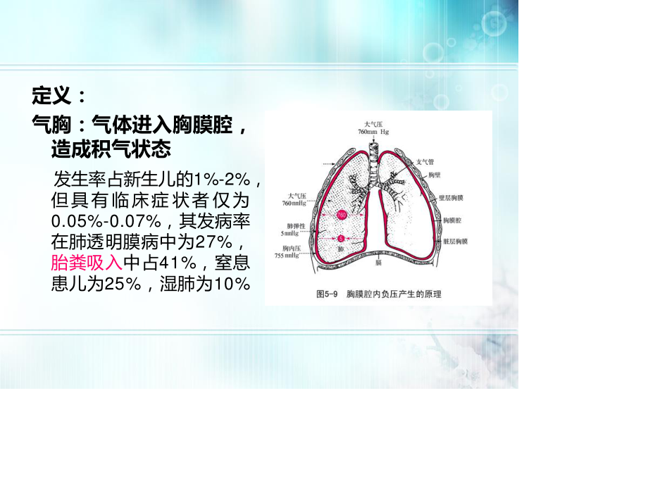 新生儿气胸.ppt_第3页