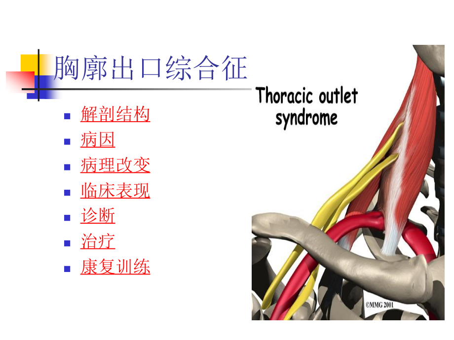 胸廓出口综合征.ppt_第3页