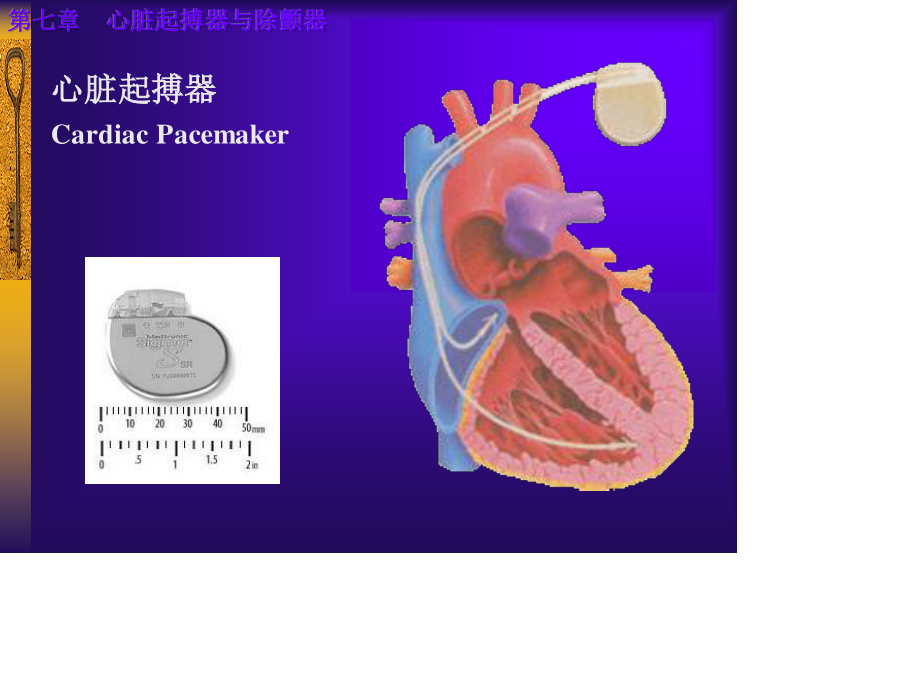 心脏起搏器与除颤器.ppt_第2页