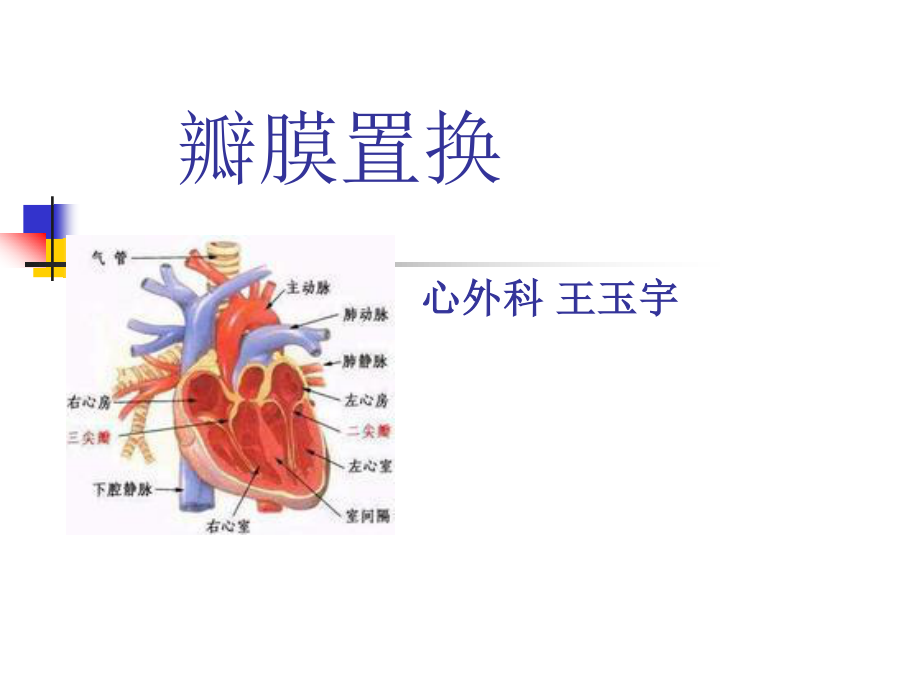 心脏瓣膜病个案2.ppt_第1页