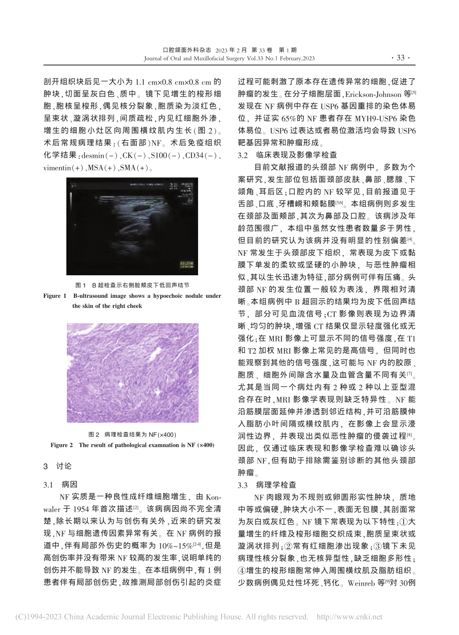 头颈部结节性筋膜炎21例临床分析_王任铎.pdf_第3页