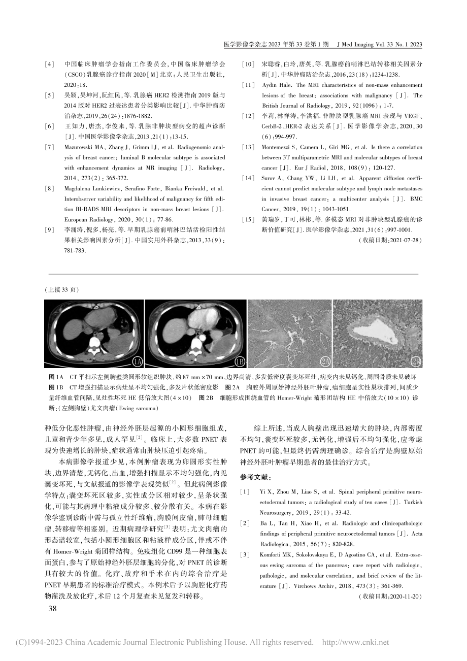 胸壁尤文肉瘤1例_赵丽.pdf_第2页