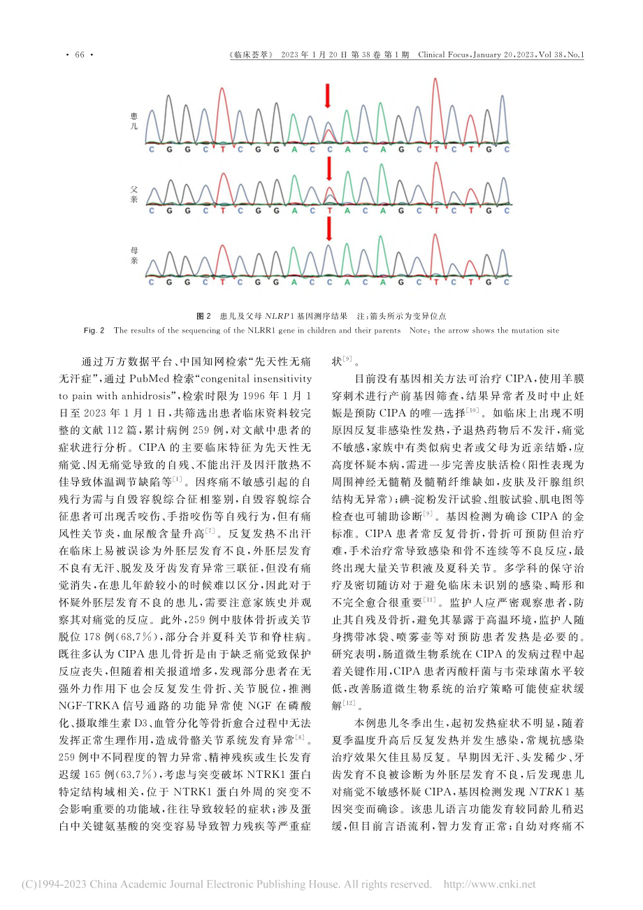 先天性无痛无汗症1例并文献复习_庞姝.pdf_第3页