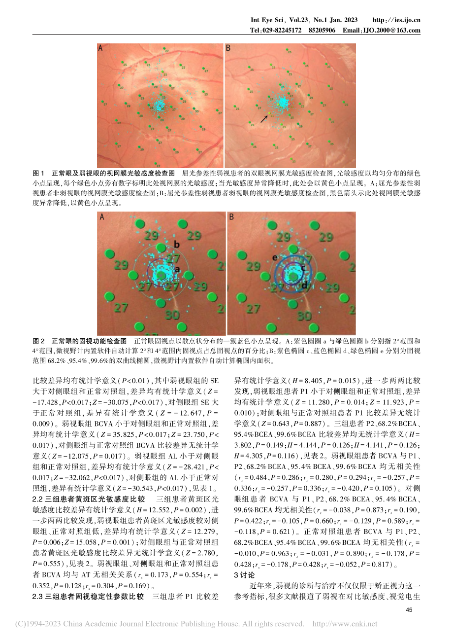 应用微视野计评估弱视儿童的黄斑光敏感度和固视稳定性_李芳.pdf_第3页