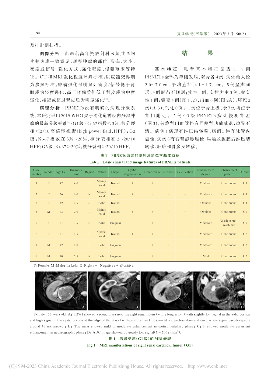 原发性肾脏神经内分泌肿瘤的CT和MRI表现_王睿婷.pdf_第3页