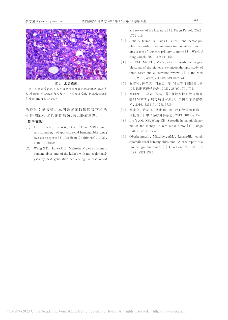 原发性肾血管母细胞瘤1例报道_殷思范.pdf_第3页