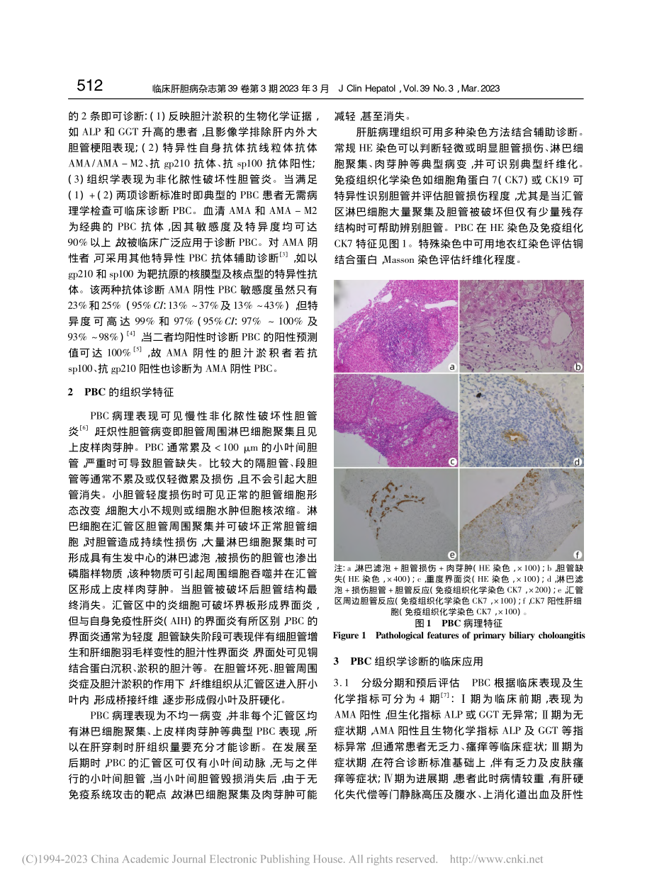 原发性胆汁性胆管炎诊治——病理是否必需__刘红丽.pdf_第2页