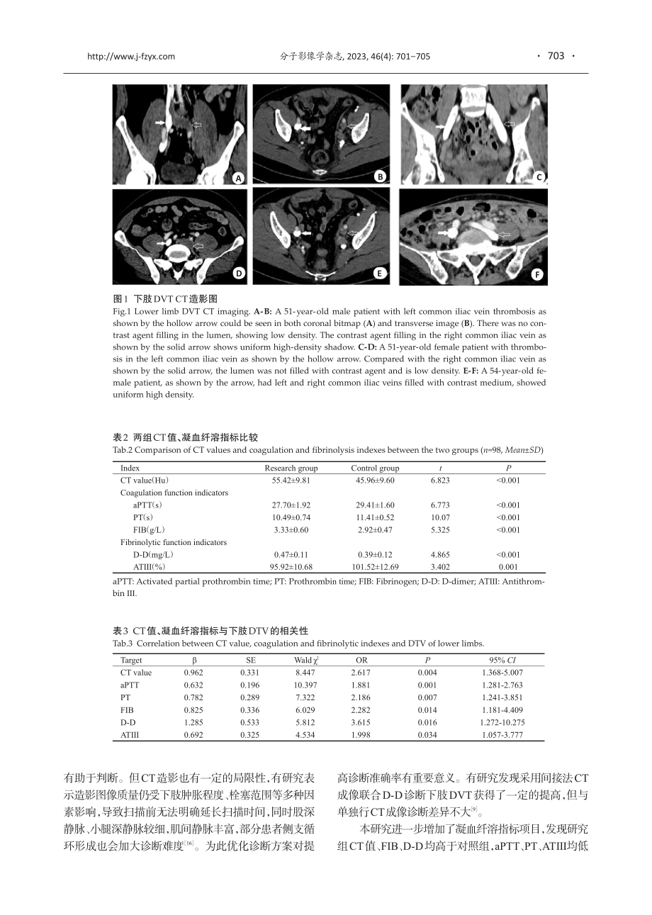 CT值联合凝血纤溶相关指标对下肢深静脉血栓发生的诊断价值.pdf_第3页