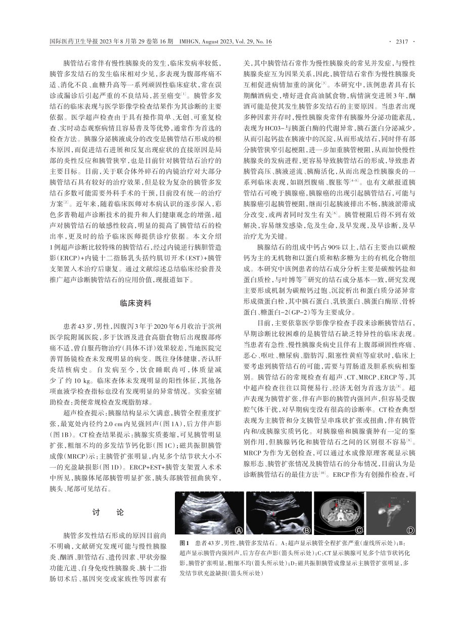 超声诊断胰管多发结石1例并文献综述.pdf_第2页