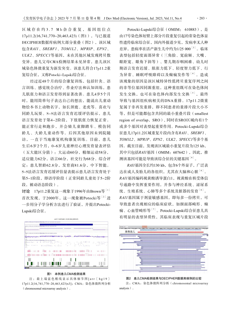 17p11.2微重复致Potocki-Lupski综合征1例报道及四年随访结果.pdf_第2页