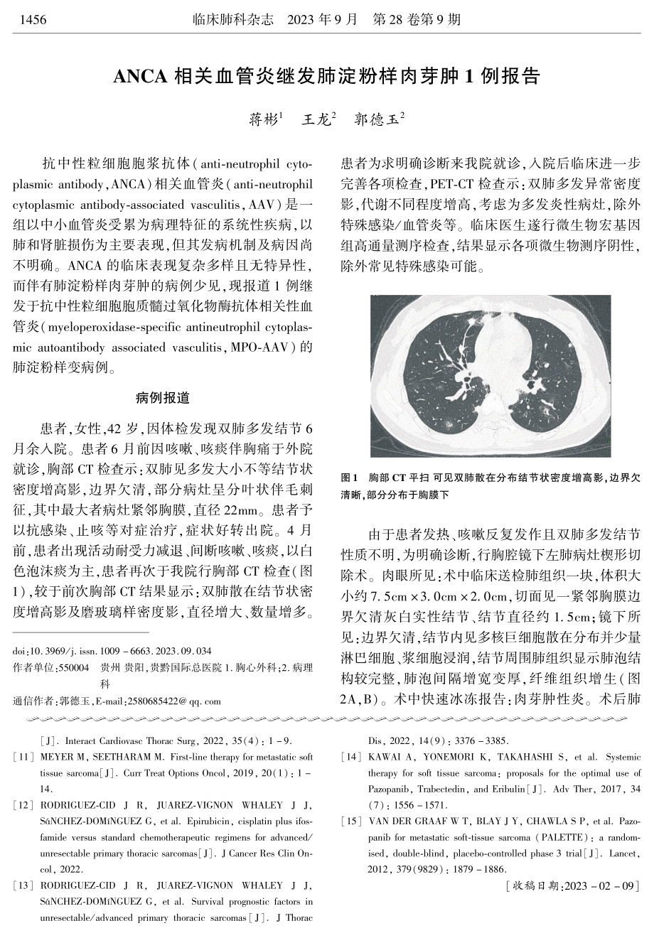 ANCA相关血管炎继发肺淀粉样肉芽肿1例报告.pdf_第1页