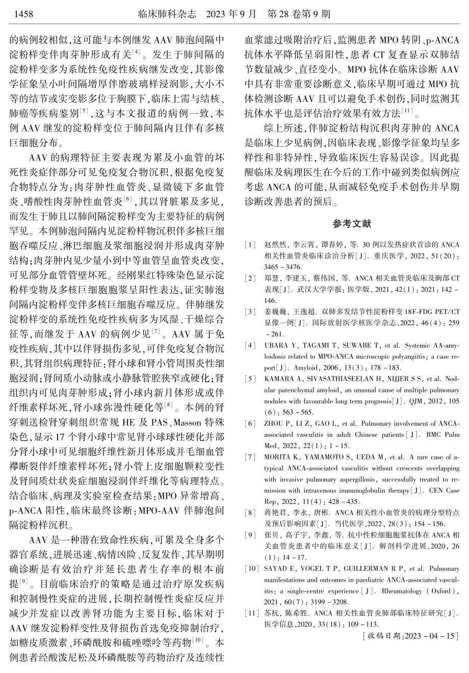 ANCA相关血管炎继发肺淀粉样肉芽肿1例报告.pdf_第3页