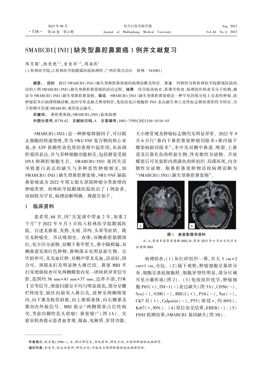 SMARCB1%28INI1%29缺失型鼻腔鼻窦癌1例并文献复习.pdf_第1页