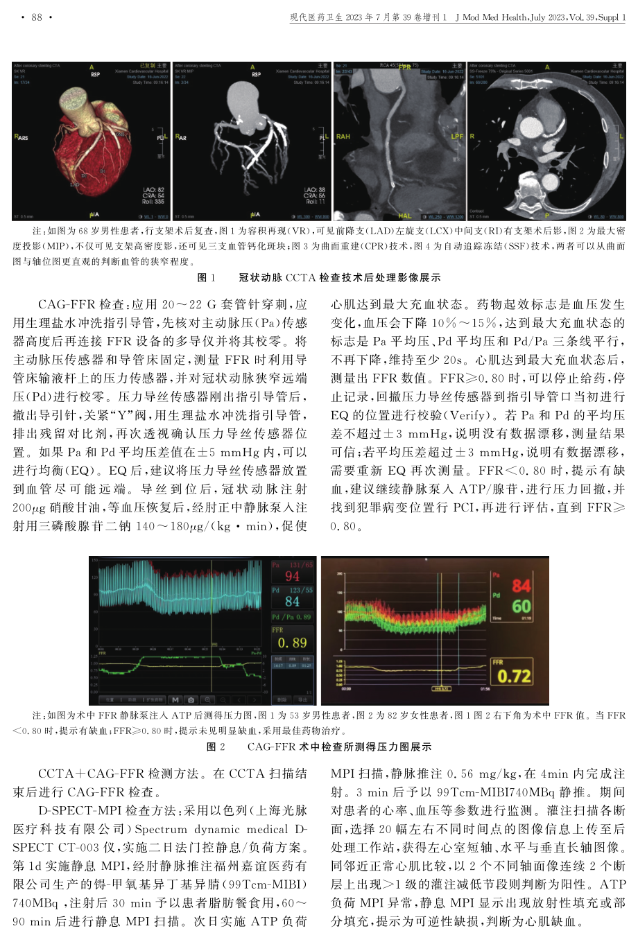 CCTA联合基于冠状动脉造影FFR对冠心病心肌缺血的诊断分析.pdf_第2页