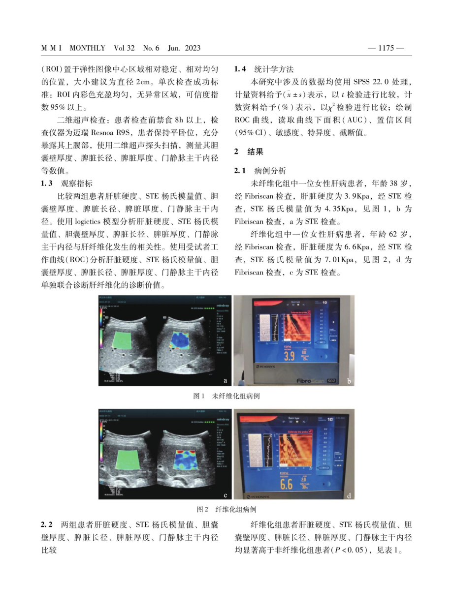 Fibriscan和声触诊弹性成像STE结合二维超声对肝病及其肝纤维化的诊断分析.pdf_第2页