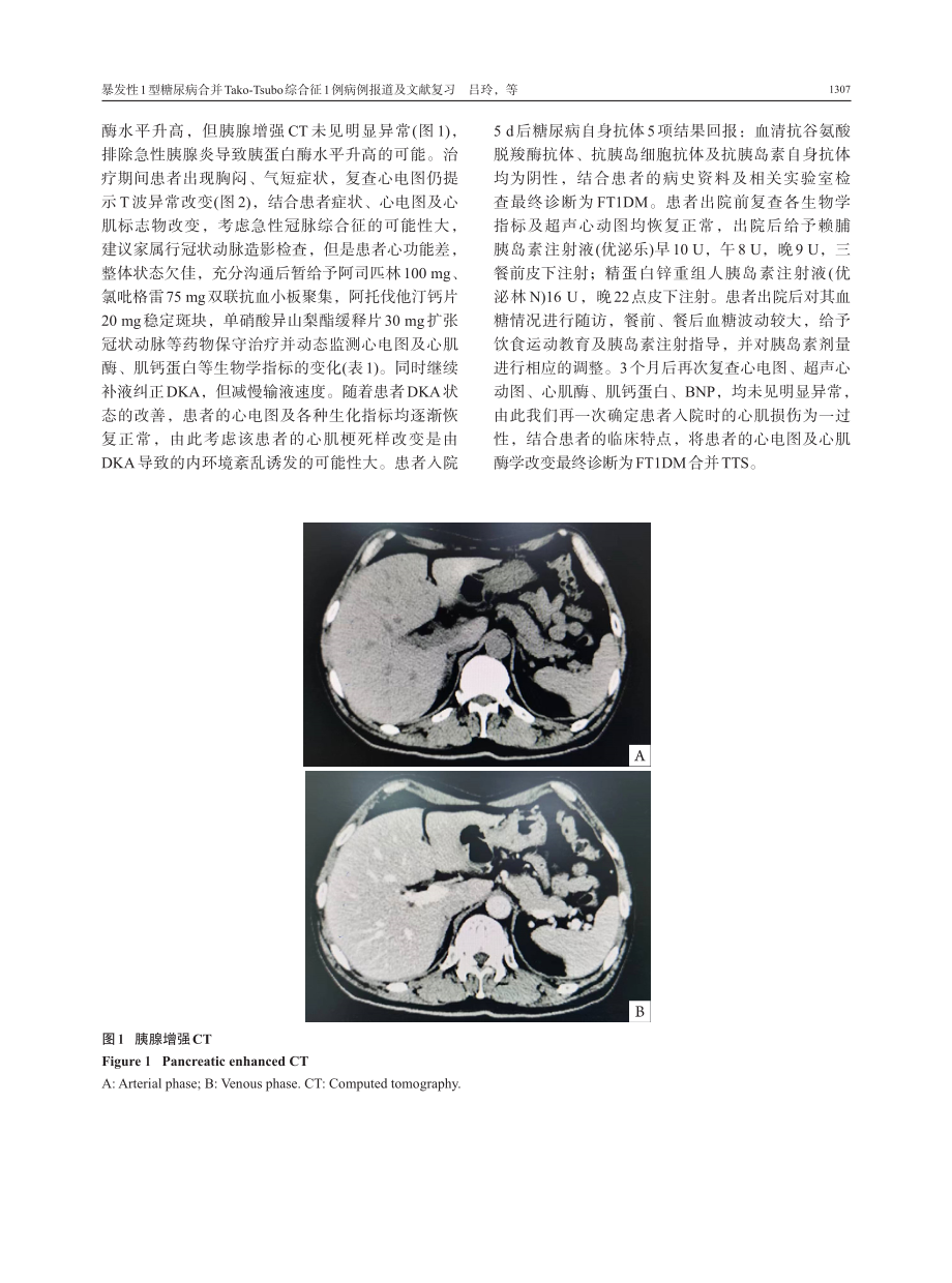 暴发性1型糖尿病合并Tako-Tsubo综合征1例病例报道及文献复习.pdf_第3页