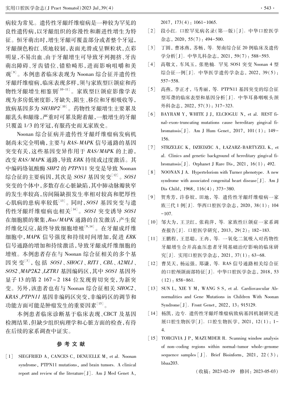 Noonan综合征病合并遗传性牙龈纤维瘤病1例.pdf_第3页