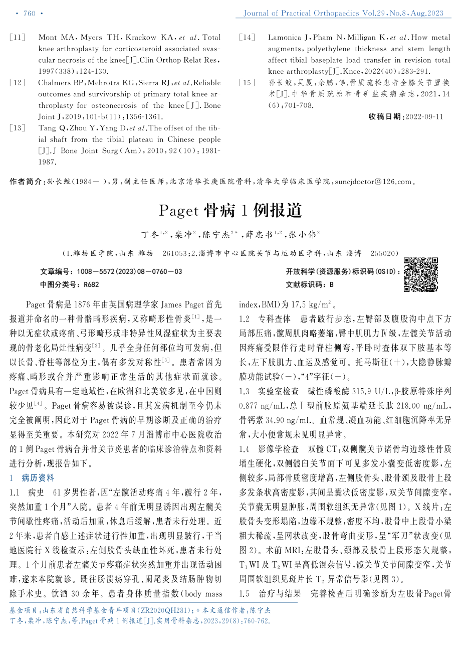 Paget骨病1例报道.pdf_第1页