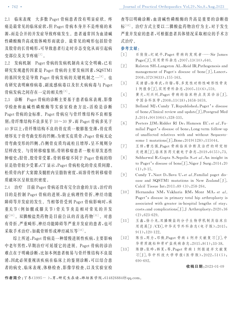 Paget骨病1例报道.pdf_第3页