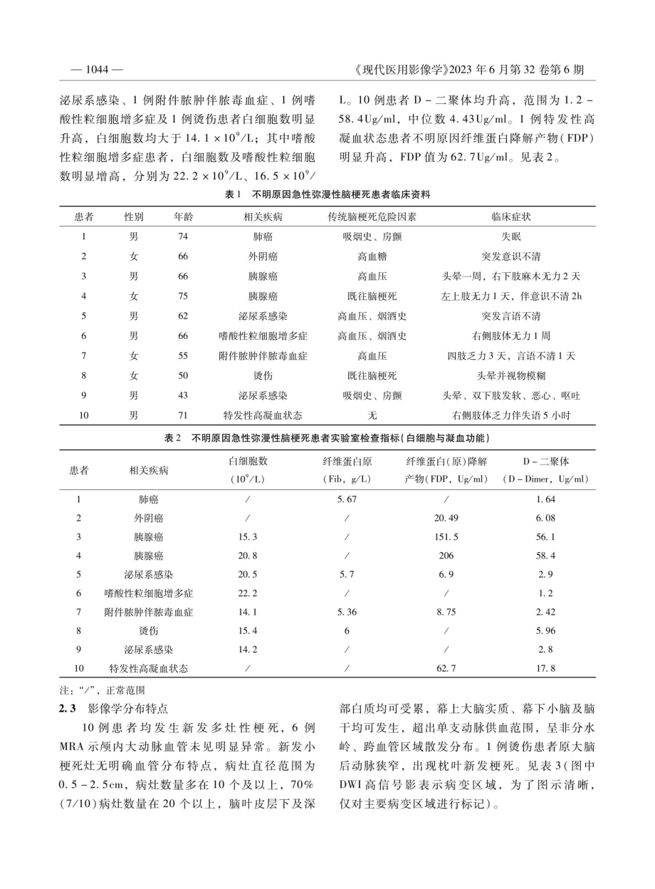 不明原因急性弥漫性脑梗死的影像特点及常见病因.pdf_第3页