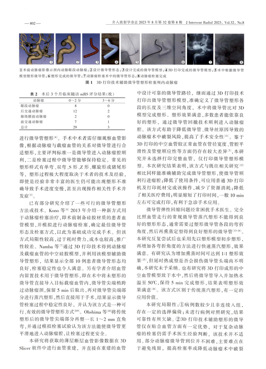 3D打印技术辅助微导管塑形在颅内动脉瘤栓塞术中的应用.pdf_第3页