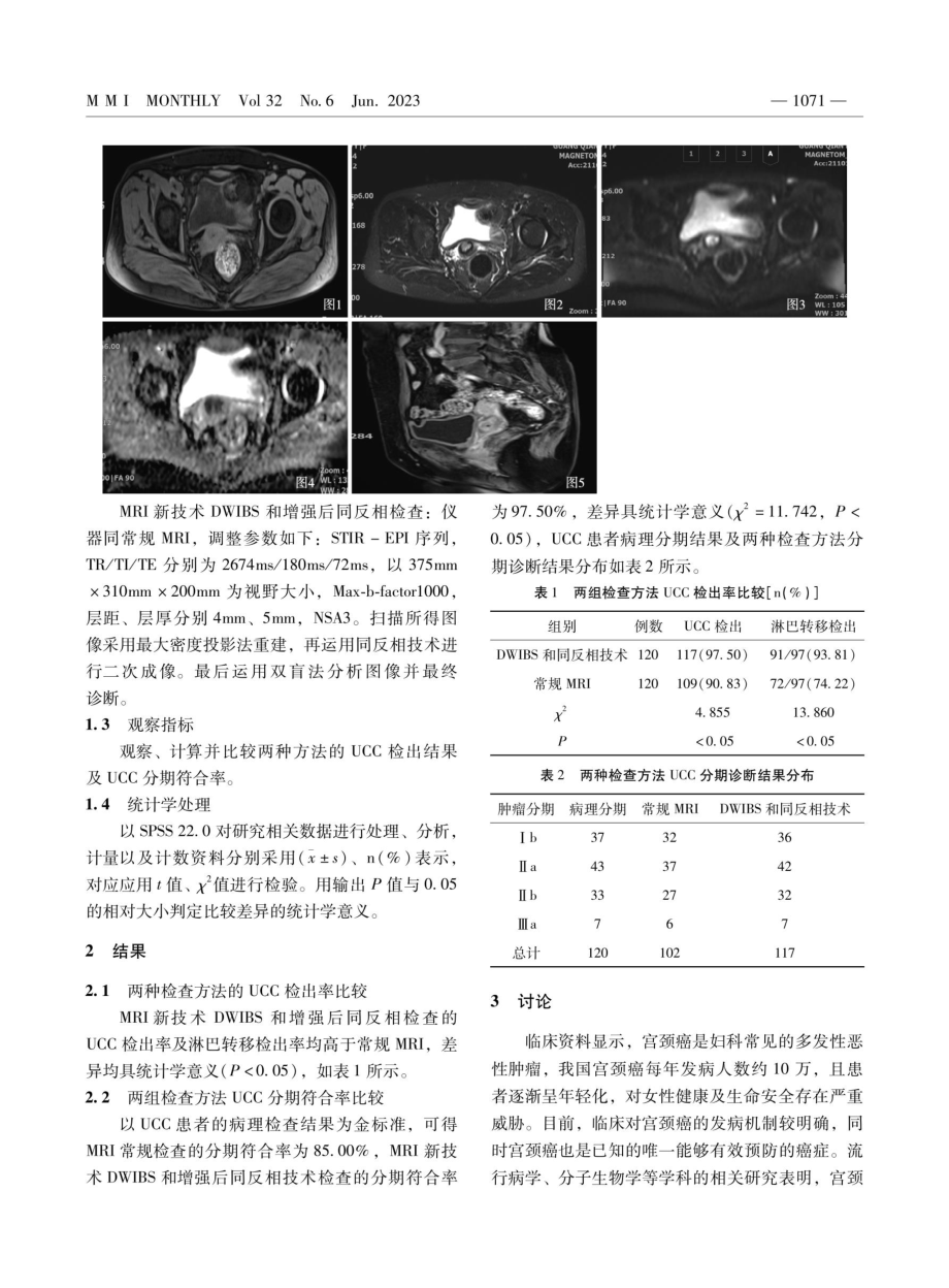 MRI新技术在宫颈癌临床分期中的应用研究.pdf_第2页