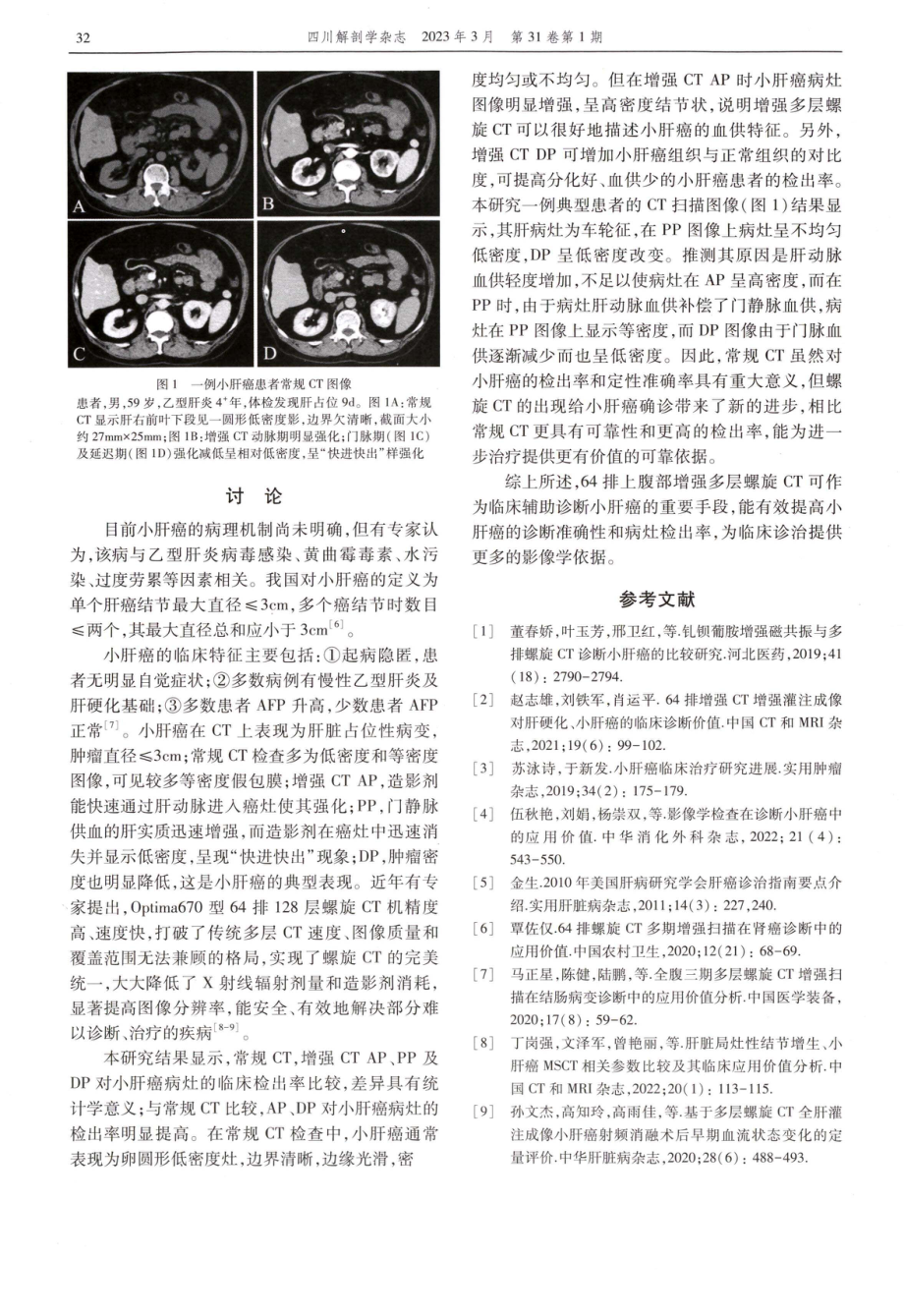 64排上腹部增强多层螺旋CT在小肝癌诊断中的应用价值研究.pdf_第3页