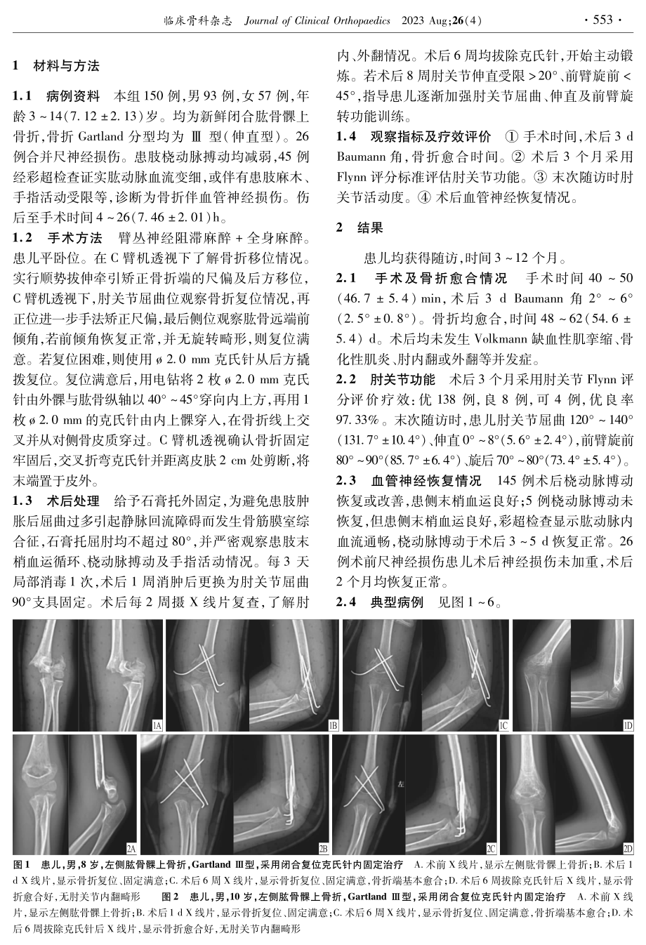 闭合复位克氏针内固定治疗儿童肱骨髁上骨折的疗效.pdf_第2页