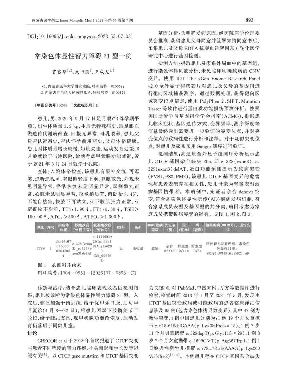 常染色体显性智力障碍21型一例.pdf_第1页