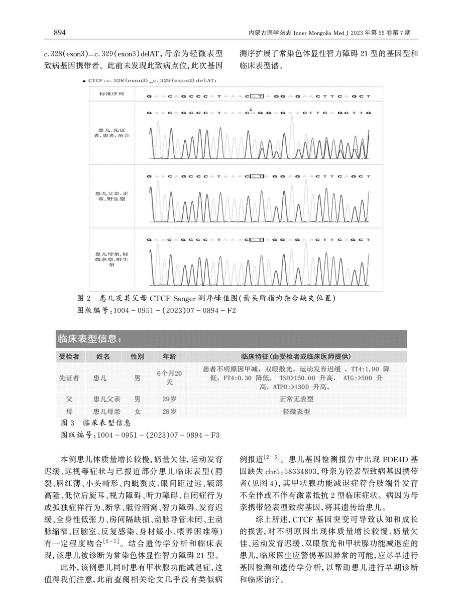 常染色体显性智力障碍21型一例.pdf_第2页