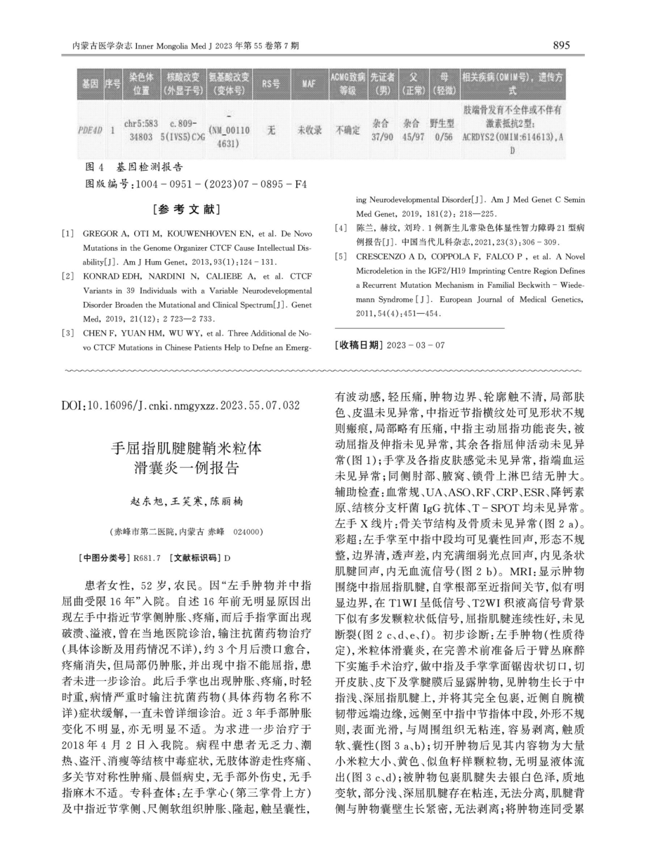 常染色体显性智力障碍21型一例.pdf_第3页