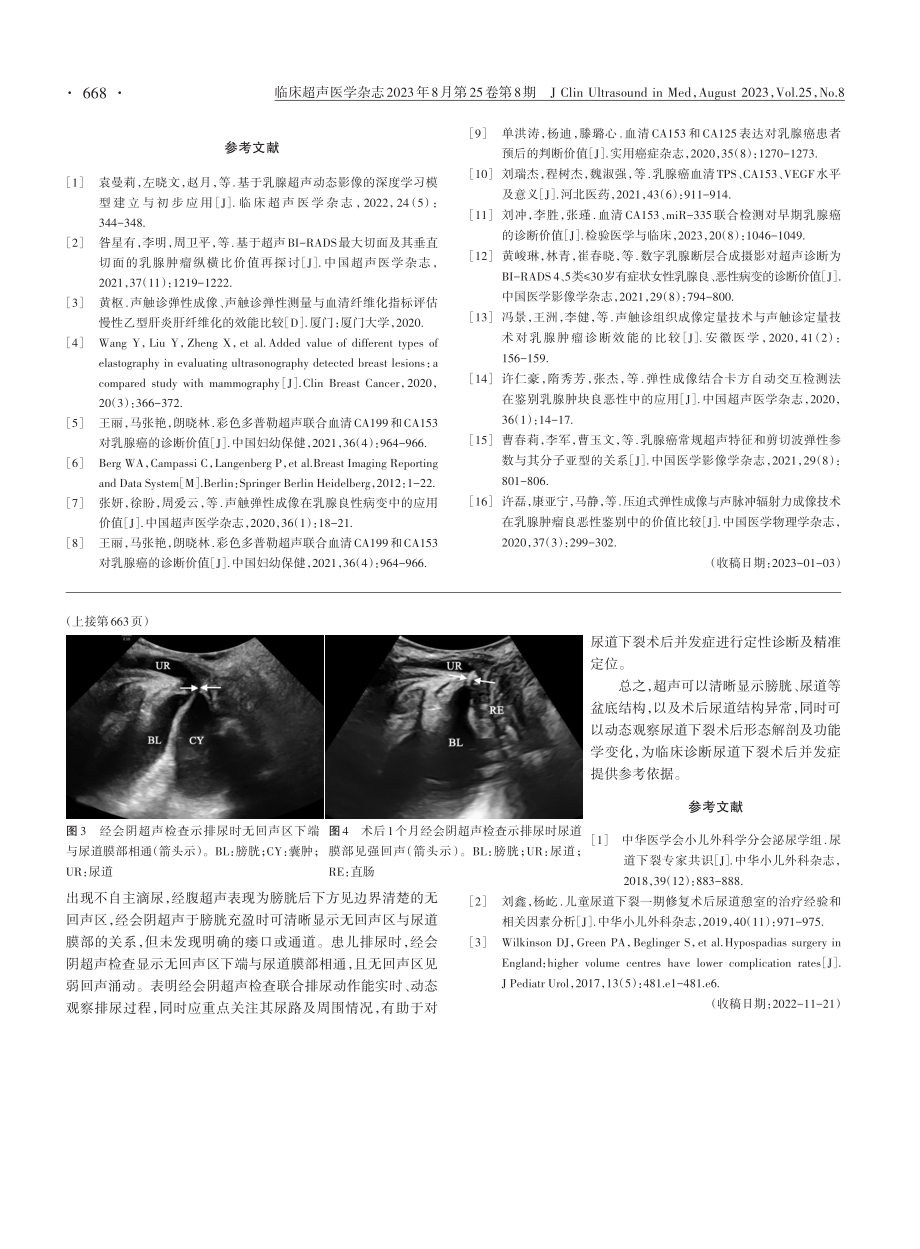 超声诊断尿道下裂术后假性尿道憩室1例.pdf_第2页