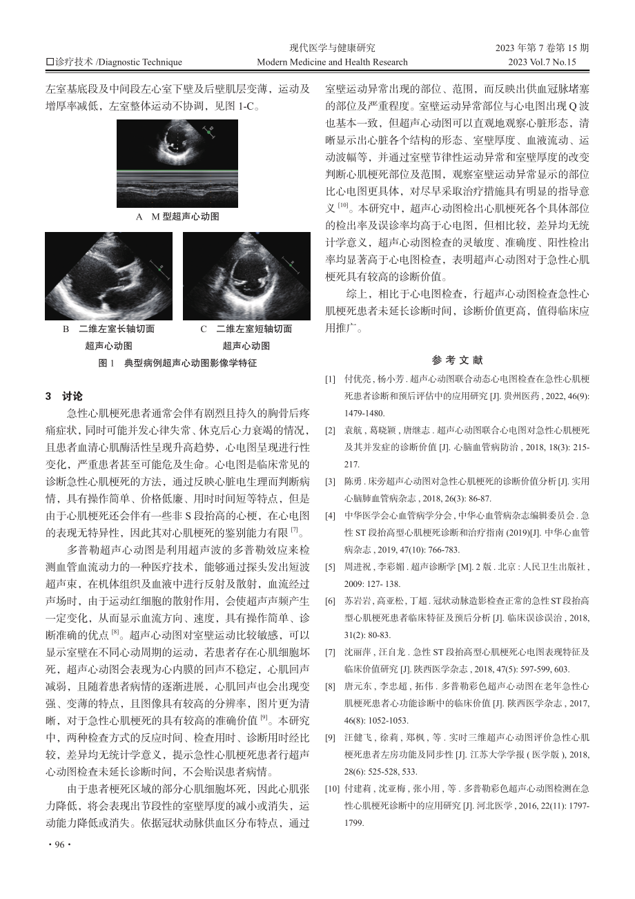 超声心动图诊断急性心肌梗死的影像学特征及效能分析.pdf_第3页