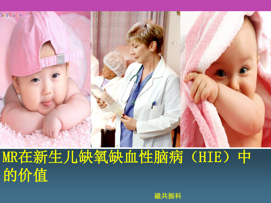 MR在新生儿缺氧缺血性脑病的价值.ppt_第1页