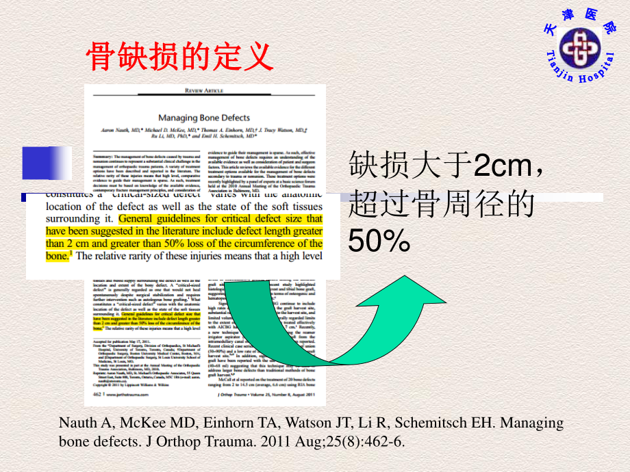 Ilizarov技术修复胫骨骨缺损.pdf_第2页