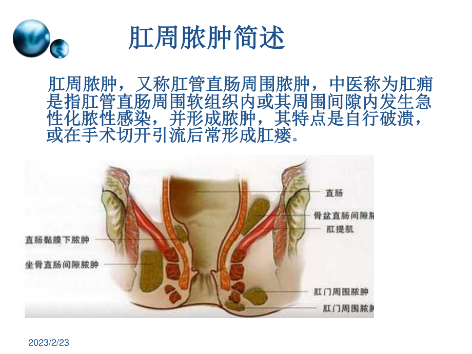 一例肛周脓肿术后换药个案.ppt_第3页