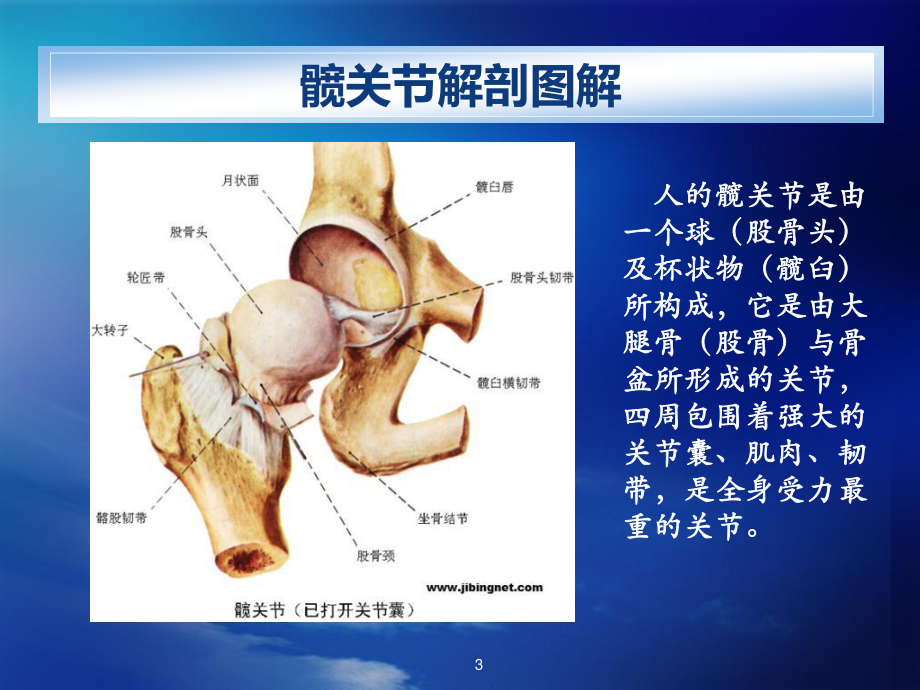 人工髋关节置换术(ppt).ppt_第3页