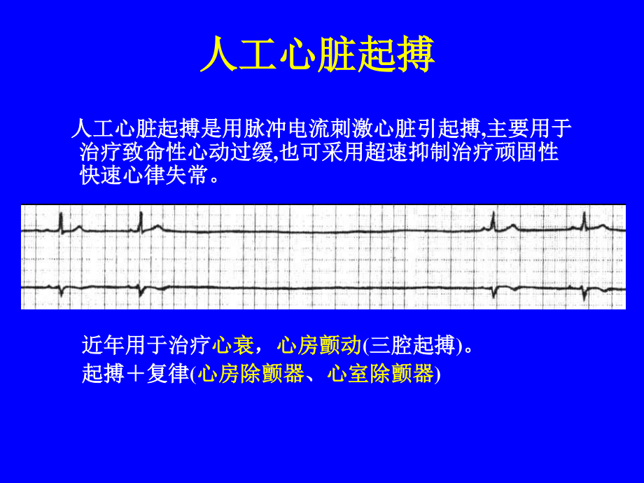 人工心脏起搏03417ppt.ppt_第1页