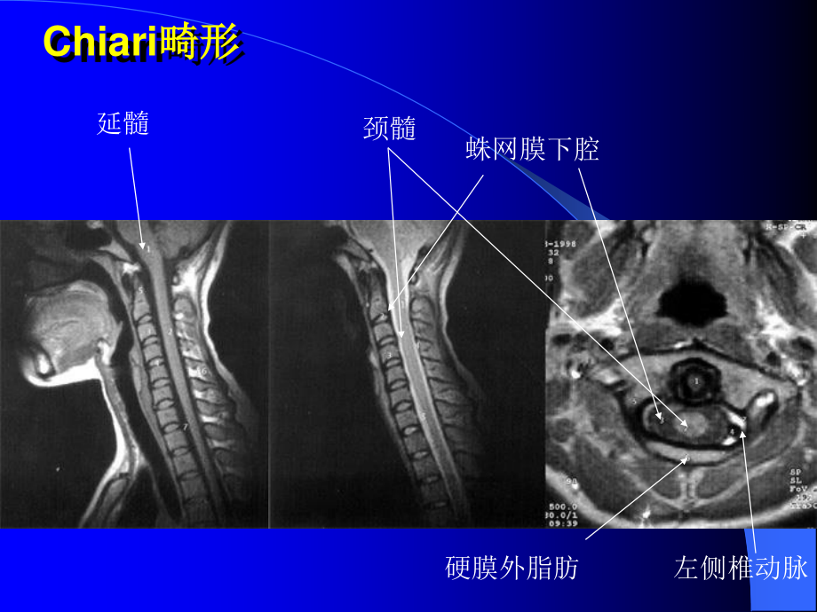 MRI图像-脑-01.ppt_第1页