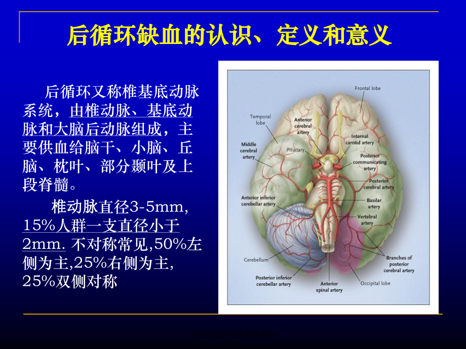 中国后循环缺血专家共识.ppt_第2页