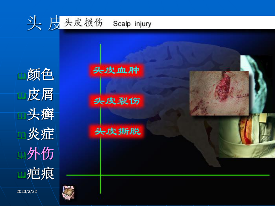 5头颈部检查.ppt_第3页