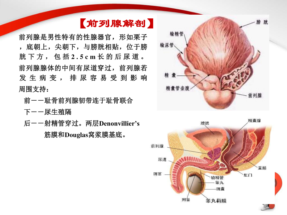 前列腺增生症.PPT.ppt_第3页