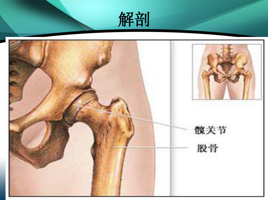 全髋置换健康讲座.ppt_第2页